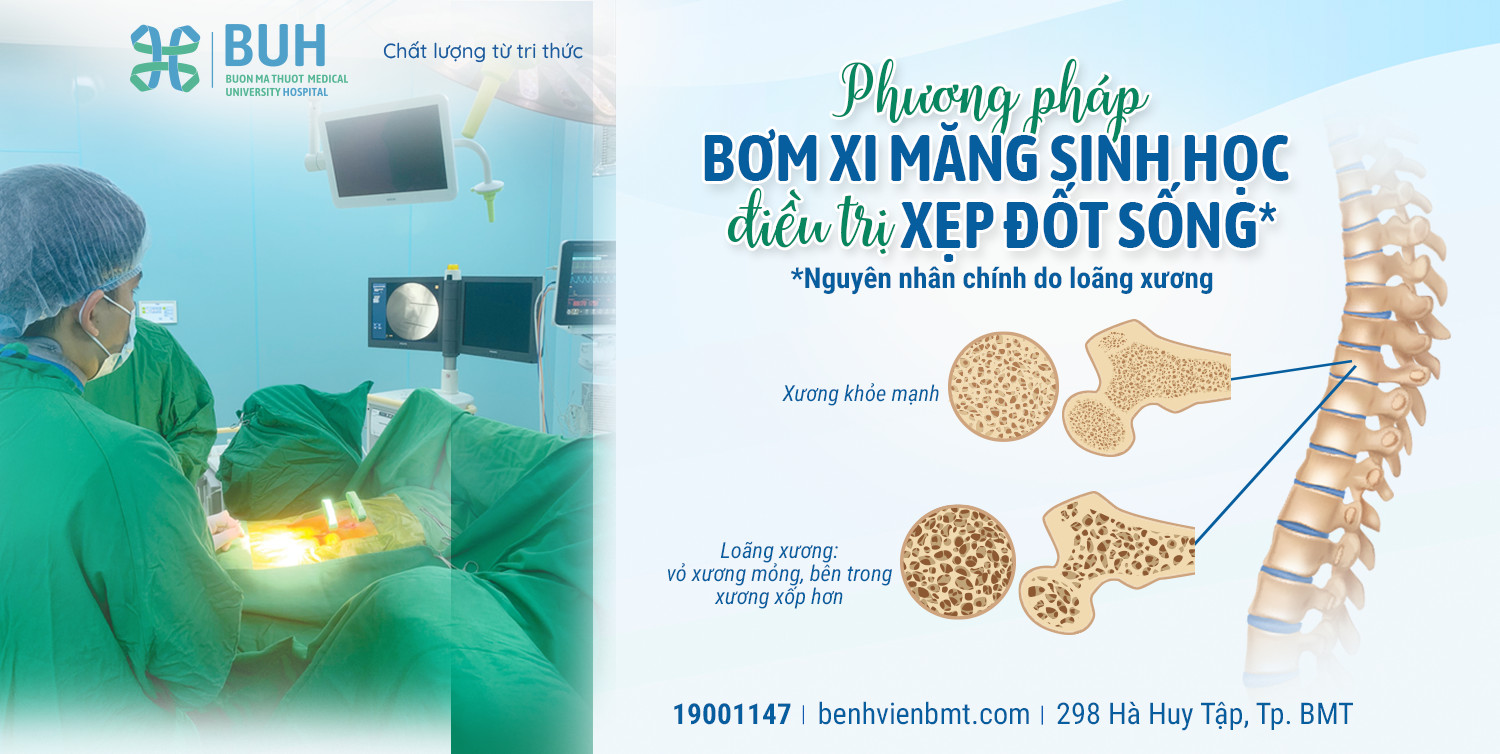 Các Kỹ Thuật Bơm Xi Măng Sinh Học Vào Đốt Sống