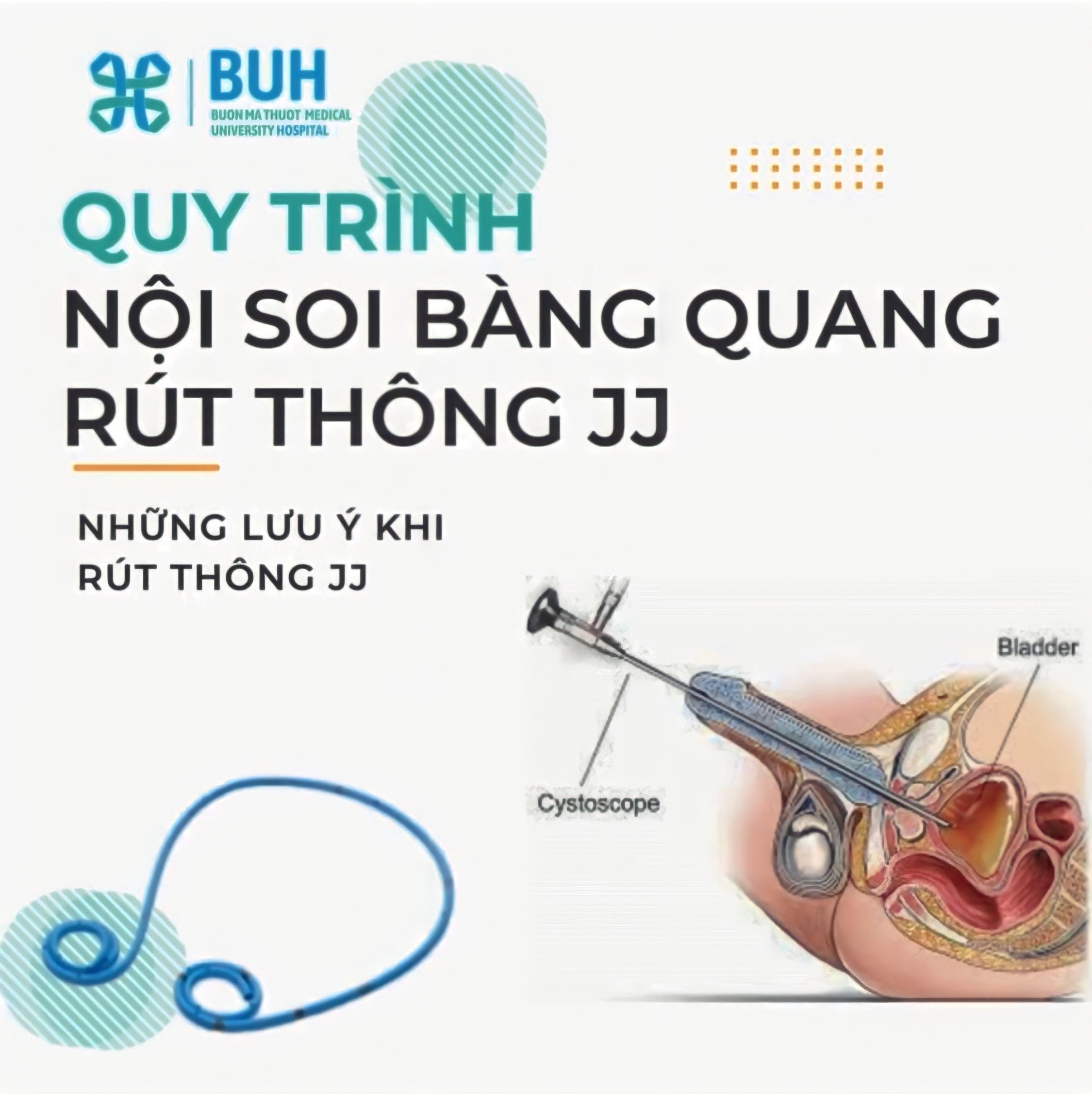 Rút Ống JJ Niệu Quản Có Gây Tê Không? Tất Cả Những Điều Bạn Cần Biết