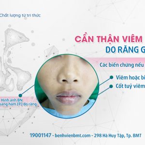 BUH PHẪU THUẬT NỘI SOI ĐIỀU TRỊ VIÊM XOANG HÀM DO RĂNG