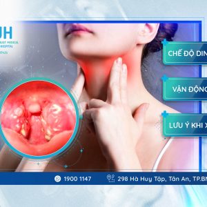 3 HƯỚNG DẪN QUAN TRỌNG VỀ CHĂM SÓC SAU PHẪU THUẬT CẮT AMIDAN