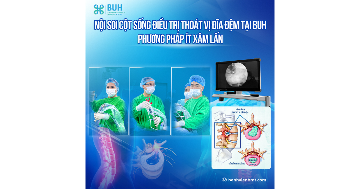 noi-soi-thoat-vi-dia-dem