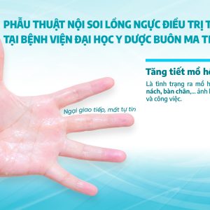 Phẫu thuật nội soi lồng ngực điều trị tăng tiết mồ hôi tại Bệnh viện Đại học Y Dược Buôn Ma Thuột