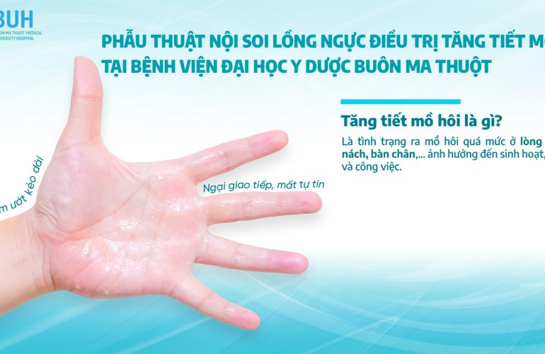 Phẫu thuật nội soi lồng ngực điều trị tăng tiết mồ hôi tại Bệnh viện Đại học Y Dược Buôn Ma Thuột