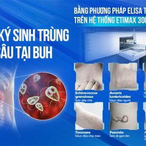 XÉT NGHIỆM KÝ SINH TRÙNG CHUYÊN SÂU TẠI BUH