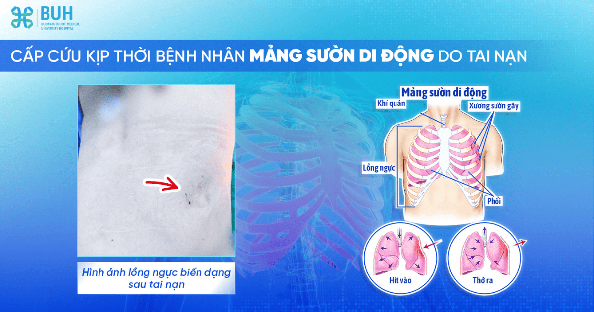 12.05MANGSUONDIDONG-Webcover (1)