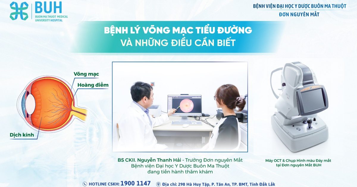 cover mắt